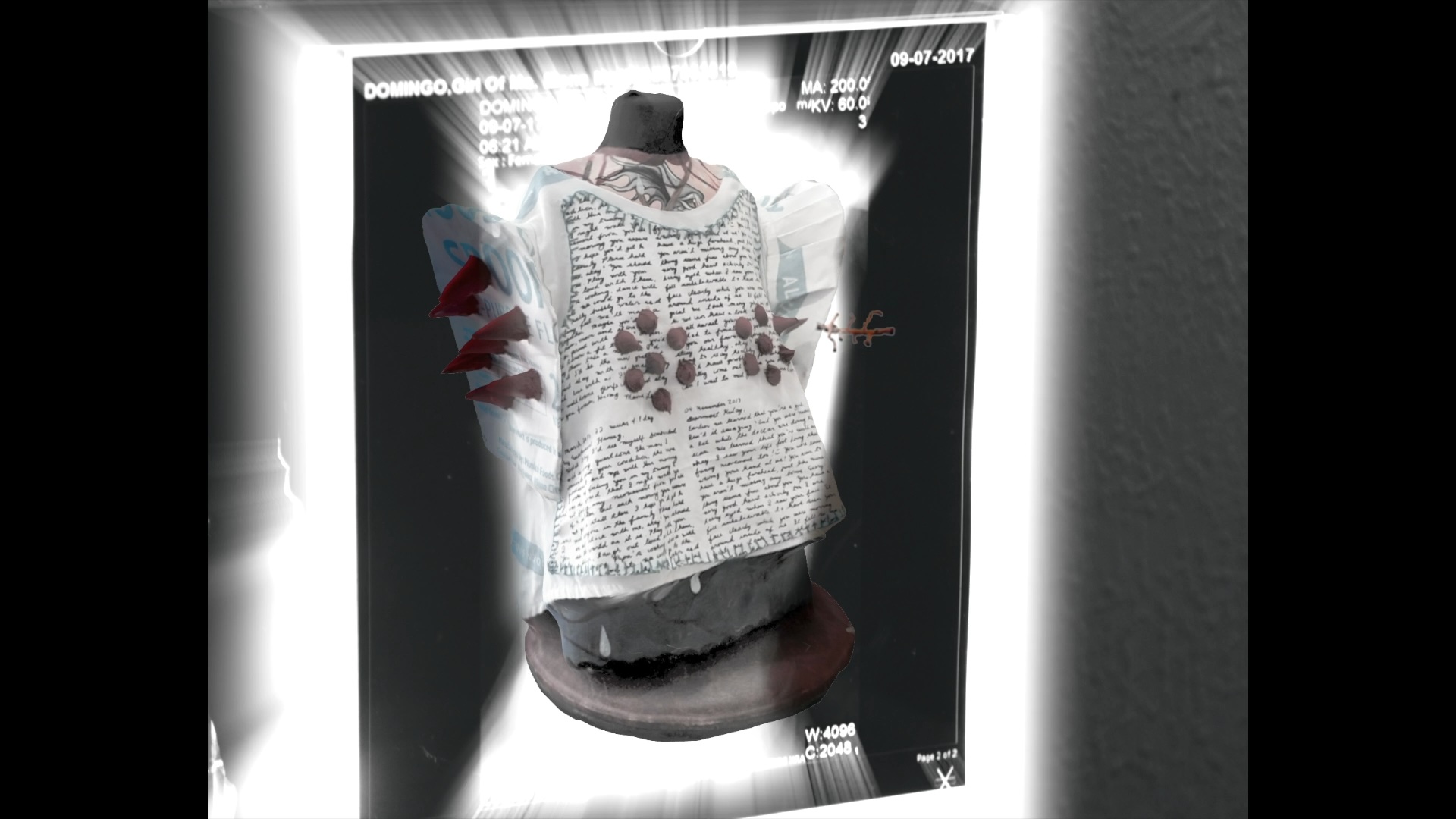 pinanganak ang Sanggol na Magtatanggol sa Kanyang Ina Thumbnail